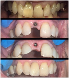 Treatment pictures